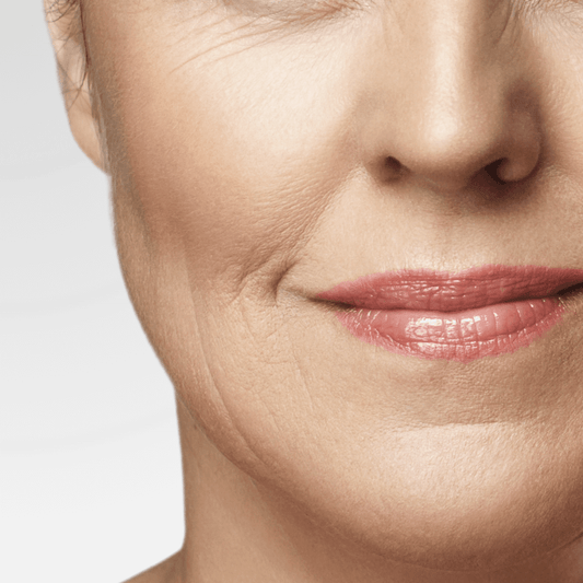 Fine Lines & Wrinkles treatment